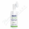 Biotter NC ACNE �ist�c� p�na na obli�ej 100ml